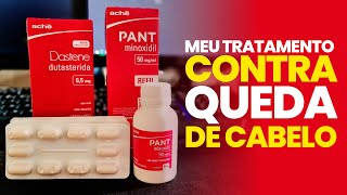 MEU TRATAMENTO COM DUTASTERIDA E MINOXIDIL [upl. by Arual]