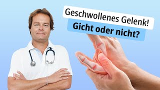 Geschwollenes Gelenk Gicht oder nicht [upl. by Tyne]