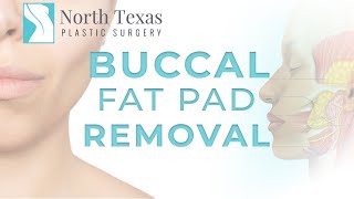 Buccal Fat Pad Removal [upl. by Sonnie]