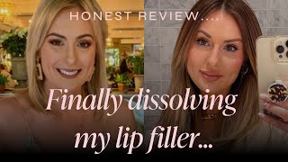 GETTING MY LIP FILLER DISSOLVED [upl. by Kus]