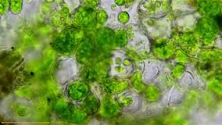 Coleochaete Algae and Zoospores microscopy [upl. by Wendeline]