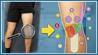 Pain in the back of your knee explained  10 most common causes and solutions [upl. by Bihas]