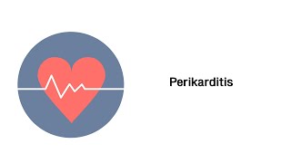 Herzbeutelentzündung Perikarditis  Herzerkrankungen [upl. by Aurelius]