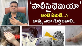 పాలీసైథెమియా అంటే ఏమిటి దాన్ని ఎలా గుర్తించాలి  hematologist  Dr Chandrasekhar Bendi [upl. by Ot87]