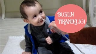 BEBEKLERDE BURUN TIKANIKLIĞI NASIL GEÇER  EN ETKİLİ ÜRÜN BABY VAC  1 ÜRÜN 1000 ÖVGÜ 2 [upl. by Merrill]