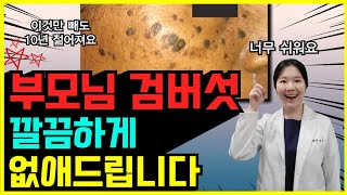 검버섯 싹 없앨 수 있습니다  노인성 흑자 지루각화증 치료방법 [upl. by Nobie]