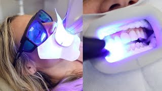 The Fastest Way Dentists Whiten Teeth  Beauty Explorers  Beauty Insider [upl. by Ashlen782]