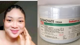 Clonovate cream [upl. by Yor]