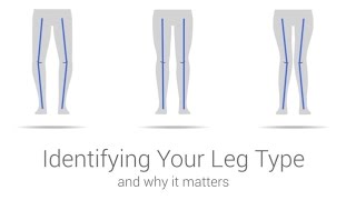 iWALK30 amp 20 Support  Identify Your Leg Type [upl. by Simonsen]