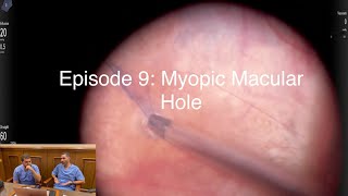 Retina Chats Episode 9 Myopic Macular hole [upl. by Kamilah344]