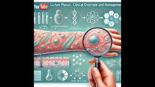 Lichen Planus Clinical Overview and Management [upl. by Malarkey]