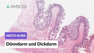 Histologie Dünndarm und Dickdarm  Mikroskopische Anatomie  AMBOSS Video [upl. by Hanna]