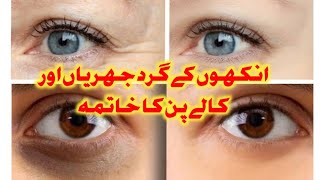 Botox treatment for eyes  how to remove under eye wrinkles [upl. by Maurine]