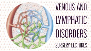 VENOUS DISORDERS lecture 1 VARICOSE VEINS description of venous system of lower limb in easy way [upl. by Eneleuqcaj]