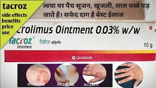 Tacroz Ointment  Tacrolimus 003 Ointment  Tacroz Ointment Uses Benefits tacroz ointment in hindi [upl. by Kalvn]