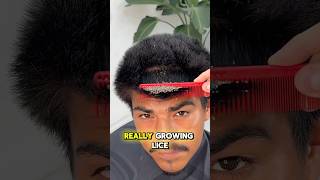 He’s growing LICE oddlysatisfying barber explore [upl. by Arraik]