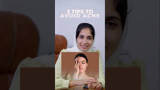 Effective Tips to Avoid Acne  Simple Steps for Clearer Skin  DrNas Health [upl. by Attekram]