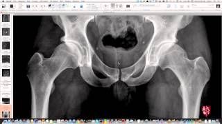 Pelvis and Hips Essential Radiography Repost [upl. by Isleen]