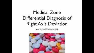 Medical Zone  Differential Diagnosis of Right Axis Deviation [upl. by Adile]