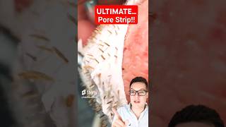 Worlds Biggest PORE STRIP REMOVAL  Proof Pore Strips Work shorts [upl. by Lemmuela830]