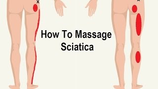 How To Reduce Sciatica Pain with Massage Trigger Point [upl. by Janina]