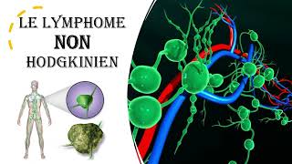 TOUT SAVOIR sur le Lymphome NON Hodgkinien [upl. by Atinele751]