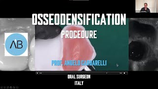 An exclusive Webinar “Sinus Lift With Osseodensification” presented by Prof Angelo Cardarelli [upl. by Nannoc]