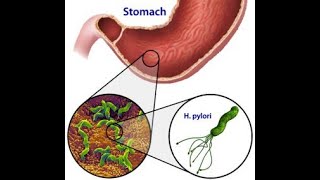 AGENTES MUTÁGENOS QUÍMICOSFÍSICOS Y BIOLÓGICOS  HELICOBACTER PYLORIPAPILOMA VIRUSCITOGENÉTICA I [upl. by Bethesde]