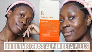 DR DENNIS GROSS ALPHA BETA PEELS REVIEW amp DEMO  GLOWY SKIN IN 2 MINUTES  byalicexo [upl. by Noirb]