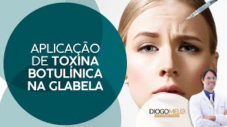 Aplicação de Toxina Botulínica na Glabela [upl. by Lagas996]