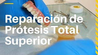 PrótesisTotales REPARACIÓN Rápida y Sencilla 👅ProtesisTotales dentaltip [upl. by Serica705]