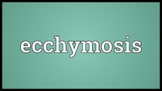 Ecchymosis Meaning [upl. by Mina]