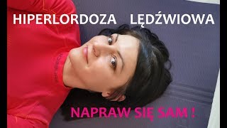 HIPERLORDOZA LĘDŹWIOWA  napraw to jednym ćwiczeniem [upl. by Tenn]