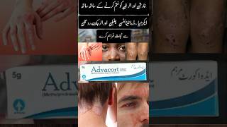 Advacort Cream ChambalDermatitis Eczema Allergy aur Kharish k ilaj k lie mufed hy shorts short [upl. by Laup]