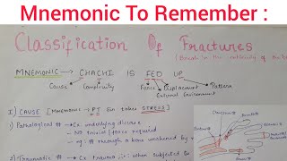 Classification Of Fractures  Simplified  How To Remember  Learn With Diagrams [upl. by Aron]