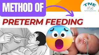 Method of Preterm Feeding I Premature Baby  Nutrition and Feeding [upl. by Yednil]