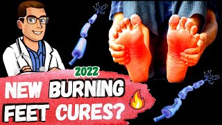 🔥Top 7 Burning Feet Causes amp Treatments 🔥 2 New Cures [upl. by Ojyllek]