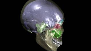 Human skull with brain endocast paranasal sinuses amp mastoid sinuses [upl. by Keeley]