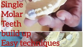 A single build up Molar Teeth easy technique [upl. by Sallyanne348]