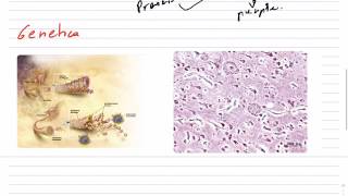 PATOGENIA Y GENETICA DE LA ENFERMEDAD ALZHEIMER [upl. by Thgiled591]