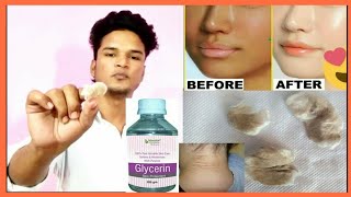 Glycerin  Uses of glycerin for mens  Hindi [upl. by Linnie533]