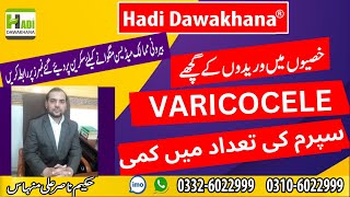 Varicocele Causes Symptoms without Surgery Treatment  Varicocele ka ilaj  Varicocele Medicines [upl. by Evette786]