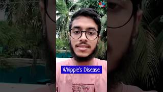 Whipples disease  Malabsorption syndrome  Pathology Medicine Surgery  Dr Med [upl. by Zenitram111]