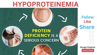 Hypoproteinemia Protein Deficiency Symptoms Causes [upl. by Salisbury]