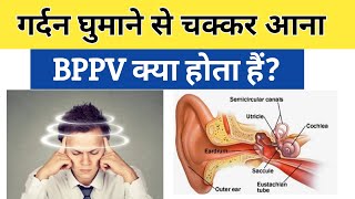 BPPV क्या हैं causes symptoms amp treatment in Hindi  Benign paroxysmal positional vertigo [upl. by Araek835]