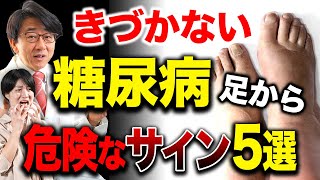 【眼科医解説】糖尿病、実は足からサイン出てるって知ってましたか？ [upl. by Acinimod]