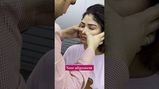 nose alignment chiropractic treatment shortfeed trending [upl. by Sefton]