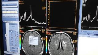 Processamento de espectroscopia [upl. by Ynettirb]