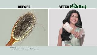 Shilpa Trust Kesh King Ayurvedic Oil – India’s No 1 Hair Fall Expert [upl. by Merl]