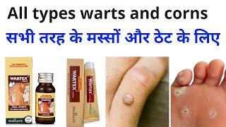 Wartex drop Wartex Cream Homeopathic medicine for Warts and corns सभी तरह के मस्सों और ठेट के लिए।। [upl. by Alejandro604]